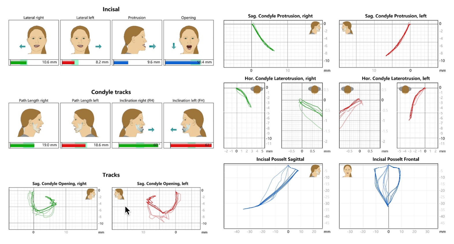 精品人妻无码一区二区三区换脸