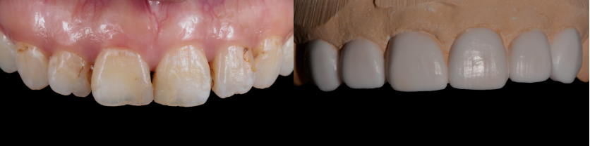 精品人妻无码一区二区三区换脸