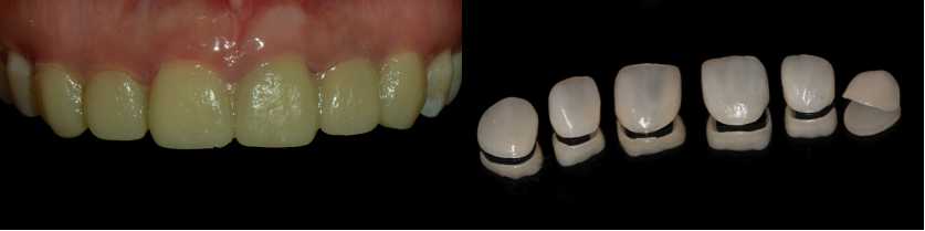 精品人妻无码一区二区三区换脸