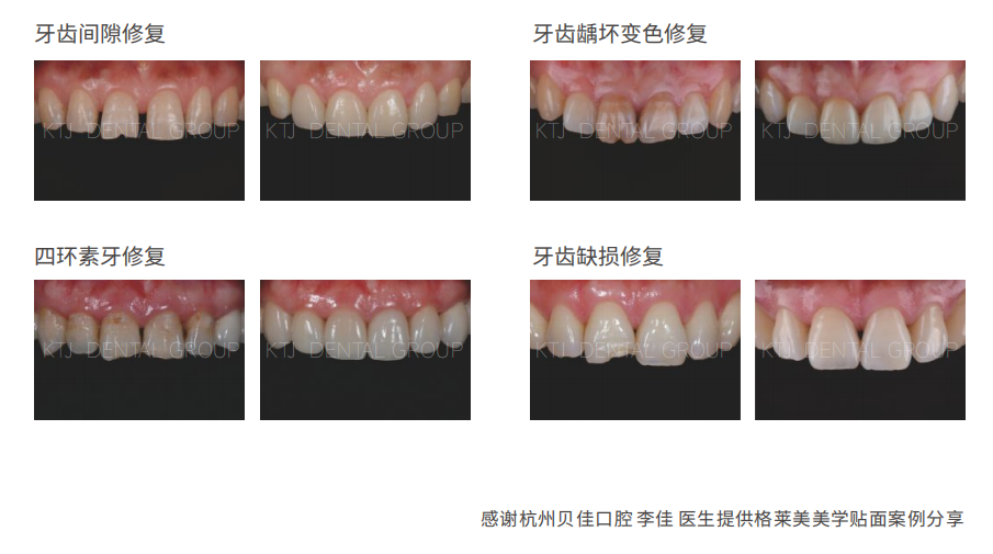 精品人妻无码一区二区三区换脸
