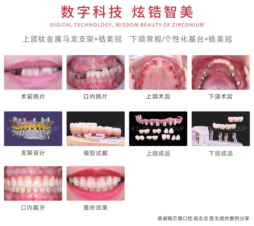 精品人妻无码一区二区三区换脸