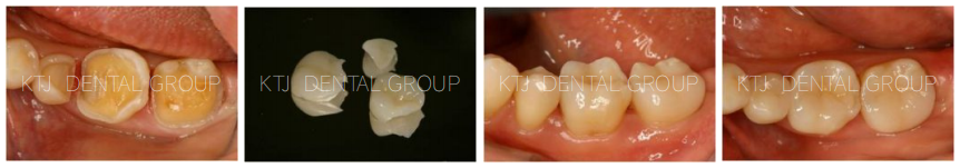 精品人妻无码一区二区三区换脸
