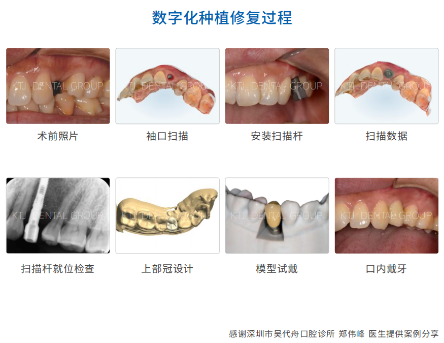 精品人妻无码一区二区三区换脸