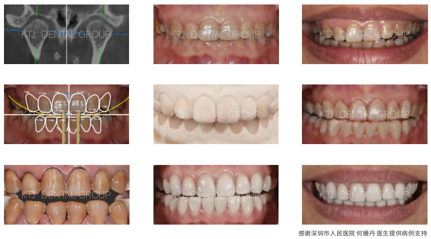 精品人妻无码一区二区三区换脸