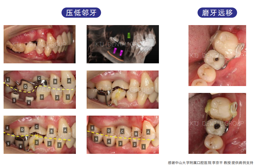 精品人妻无码一区二区三区换脸