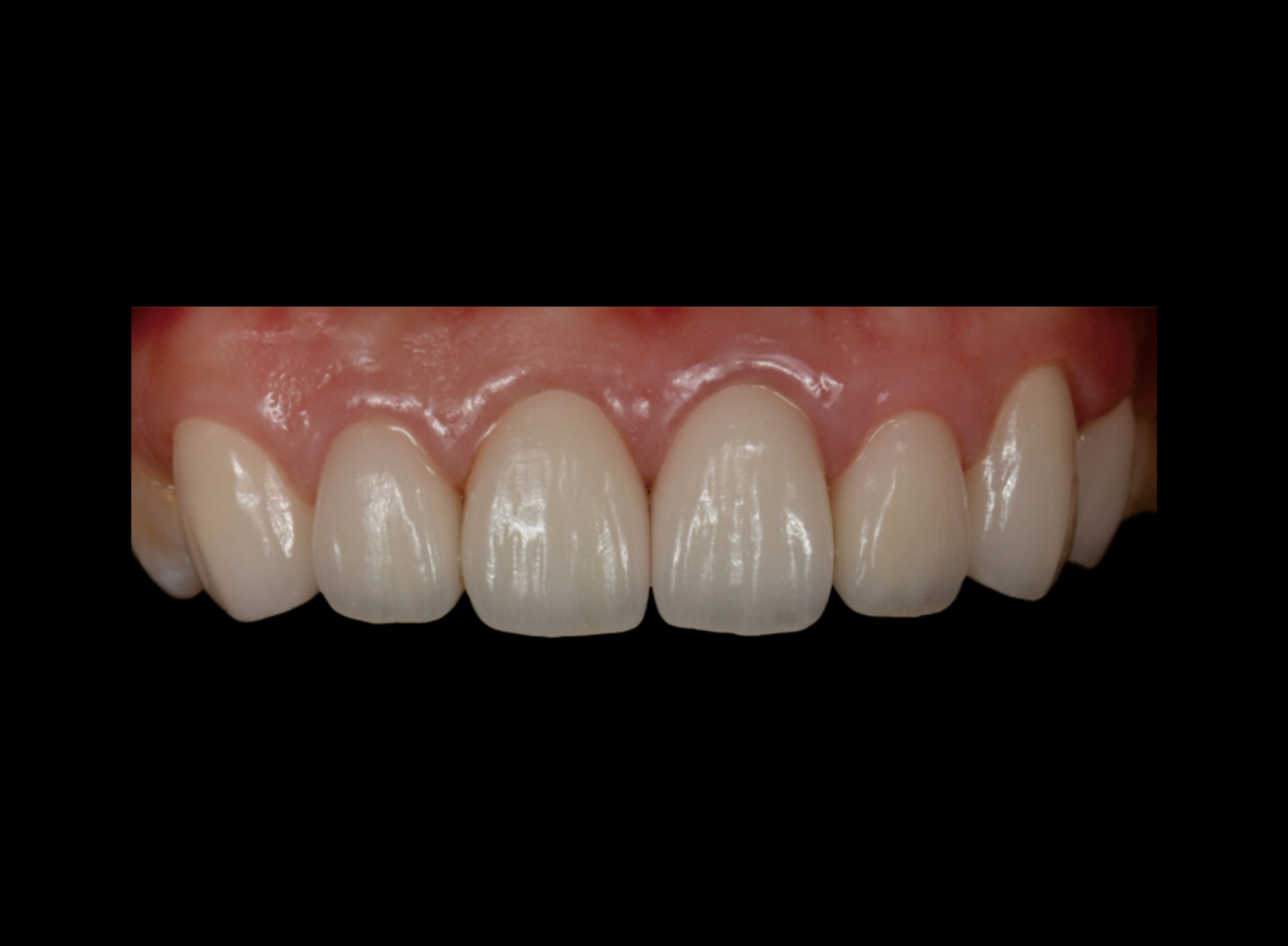 精品人妻无码一区二区三区换脸