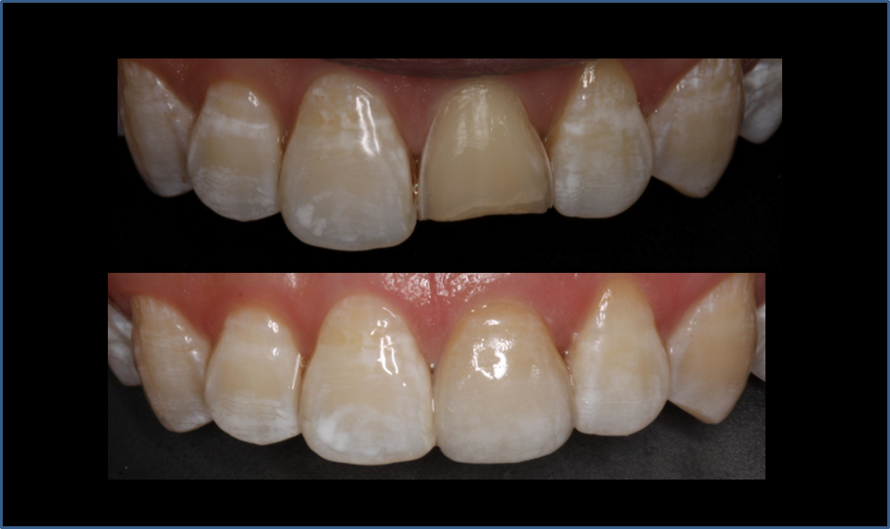 精品人妻无码一区二区三区换脸