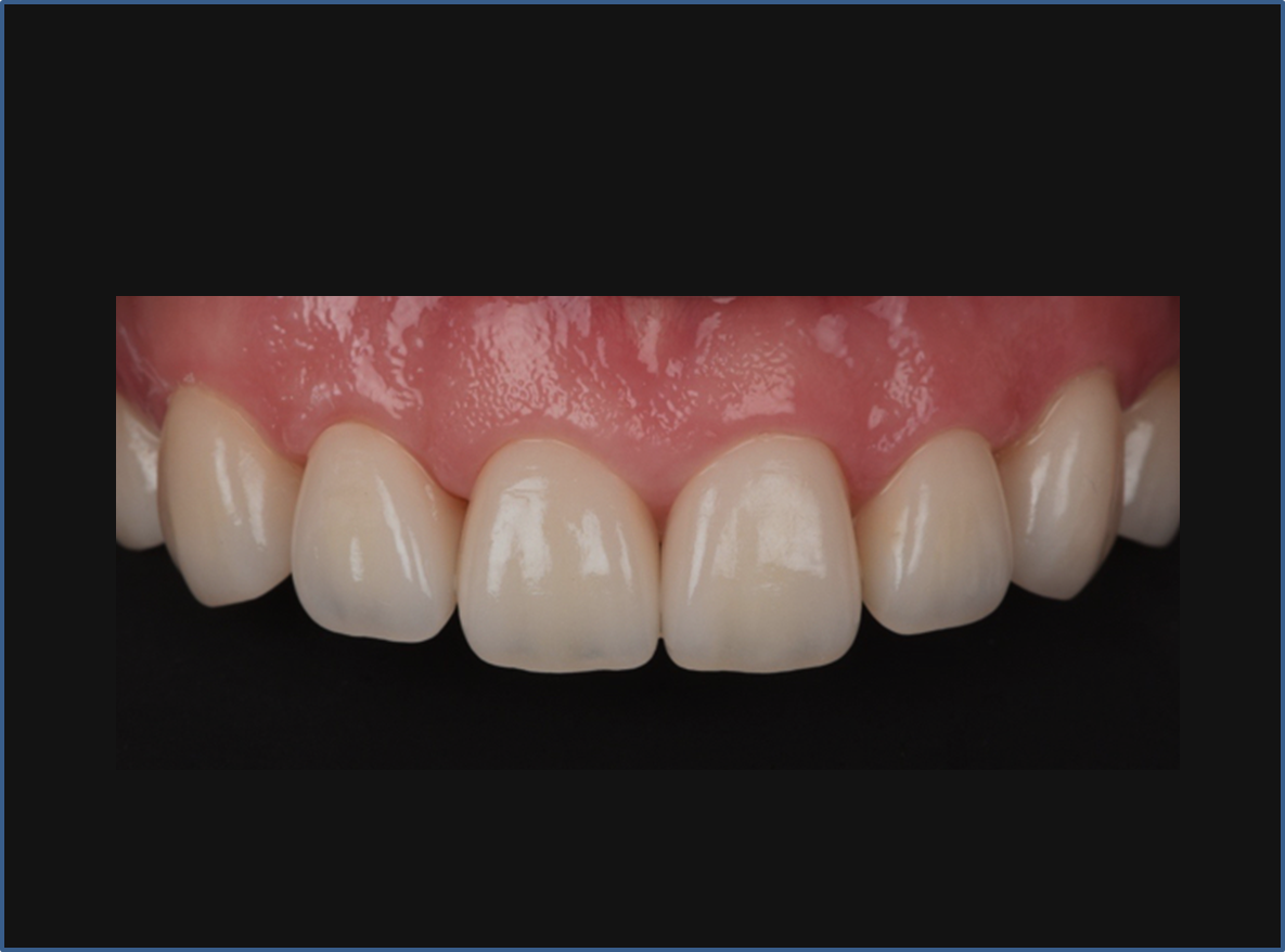 精品人妻无码一区二区三区换脸