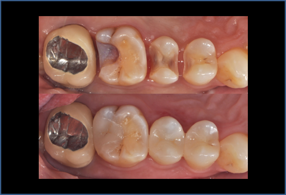 精品人妻无码一区二区三区换脸