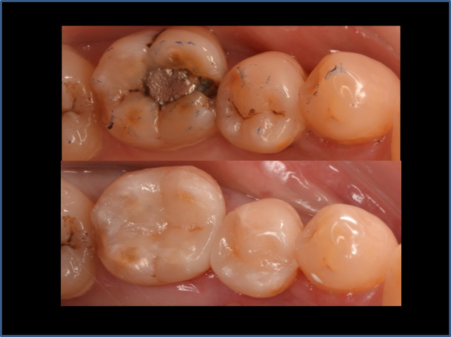 精品人妻无码一区二区三区换脸