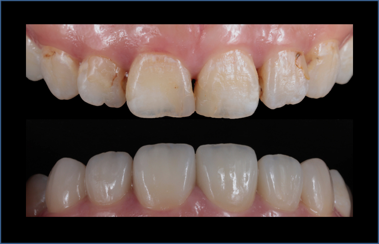 精品人妻无码一区二区三区换脸