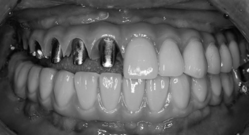 精品人妻无码一区二区三区换脸