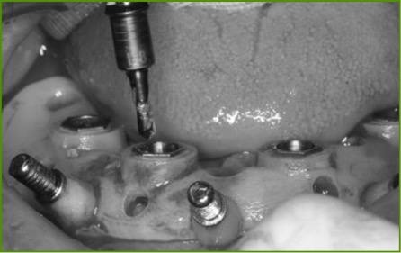 精品人妻无码一区二区三区换脸